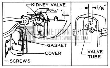 1951 Buick Removing Kidney Valve and Checking Tube